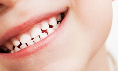 A Few Basics on Baby Teeth